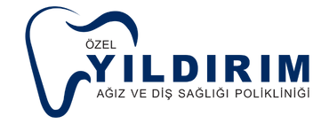 loading